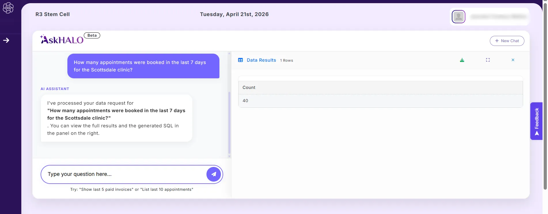 How AskHalo Works